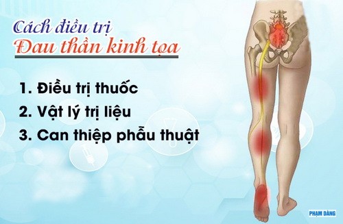 30-dau-day-than-kinh-toa-nguyen-nhan-bieu-hien-va-cach-dieu-tri-benh-4.jpg